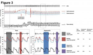Figure 2. 安静時および心筋充血時における冠血流速度と冠内圧の測定