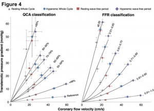 Figure 4. 冠血流速度と狭窄による圧較差の関係