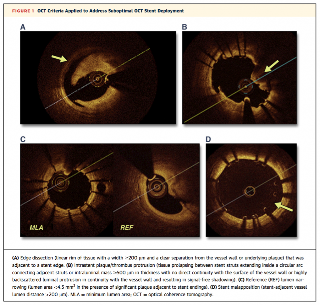 スクリーンショット 2016-02-27 20.24.46