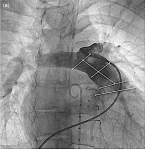 RVOT AP