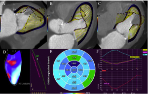 Feature tracking on MDCT